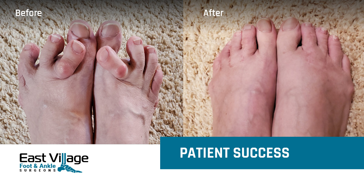 Foot Services & Procedures East Village Foot & Ankle Surgeons